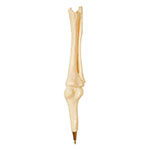 Bone Pen - Knee Joint